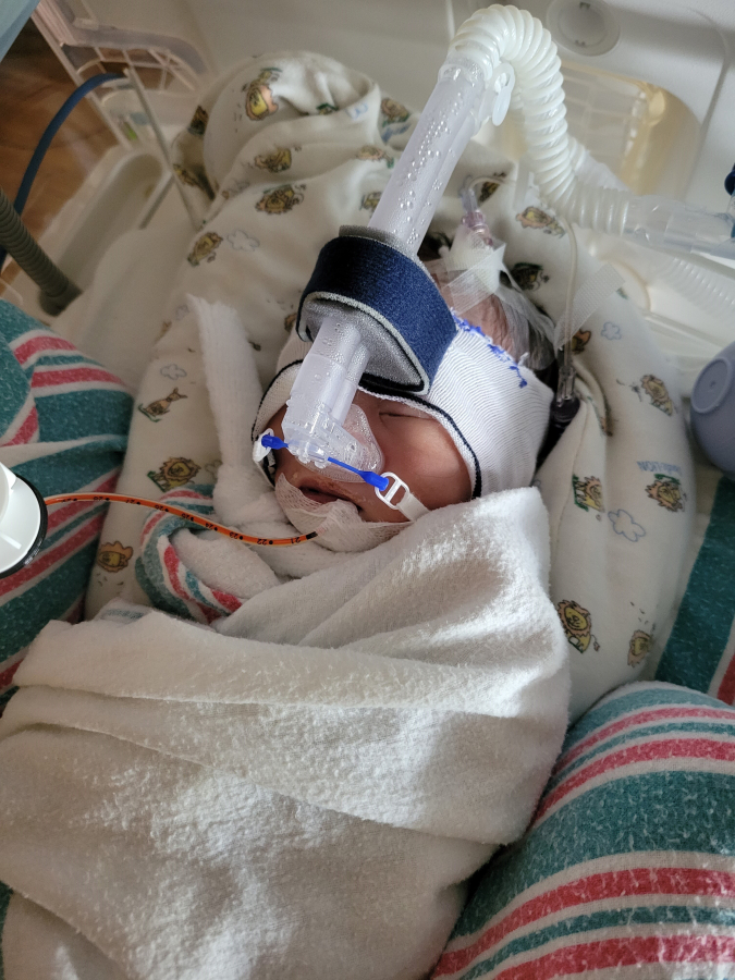 Theo Feng, of Camas, receives respiratory care shortly after his birth in July 2022.